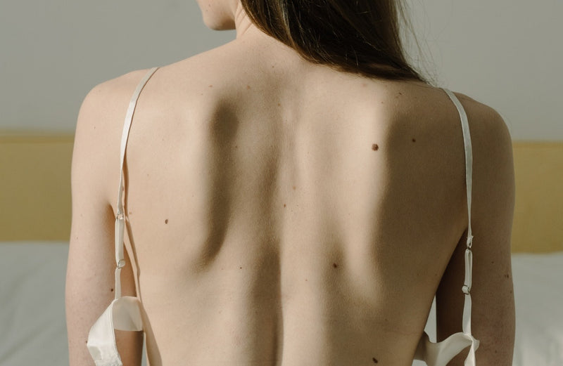 Common Causes of Back Acne and The Treatments Available